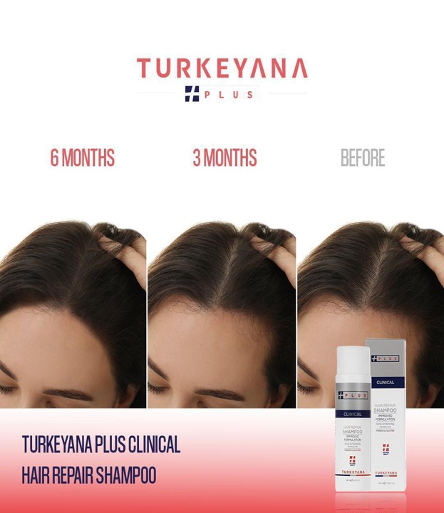 Turkeyana Plus Hair Repair Shampoo 250 ML - Image 3