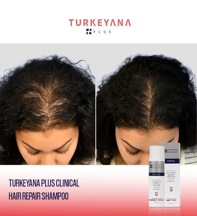 Turkeyana Plus Hair Repair Shampoo 250 ML - Image 2